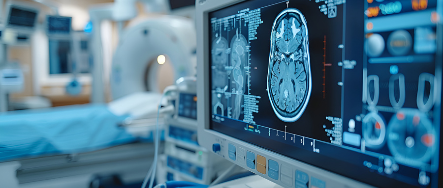 脑部结构异常？MRI为癫痫诊断提供重要线索！